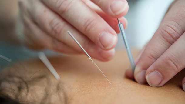Dryneedling bij Fysiopraktijk de Koningin Haarlem